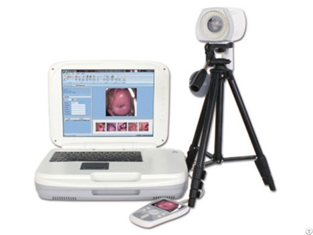 Ykd 3004 Portable Digital Colposcope