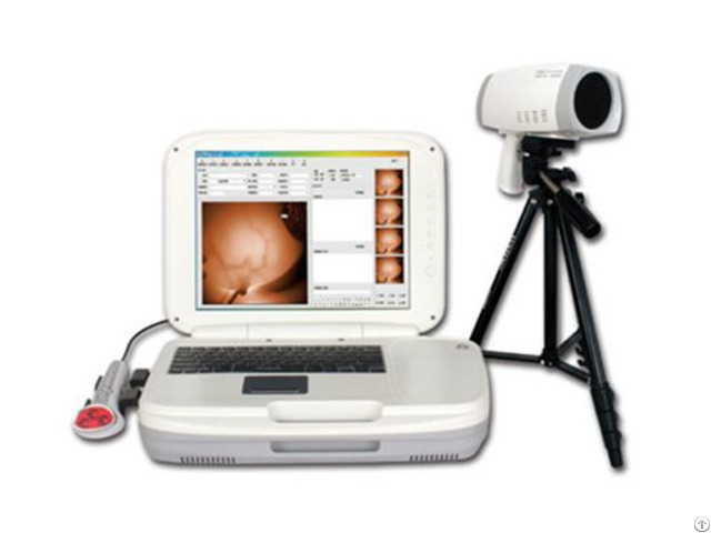 Ykd 1004 Portable Infrared Breast Examination Equipment