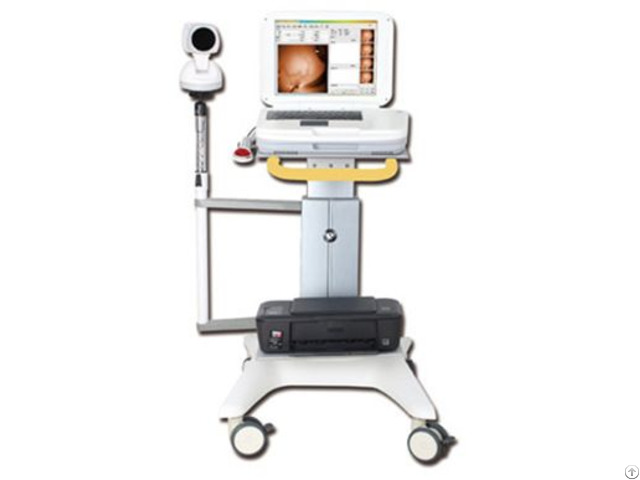 Ykd 1003 Medical Infrared Breast Examination System