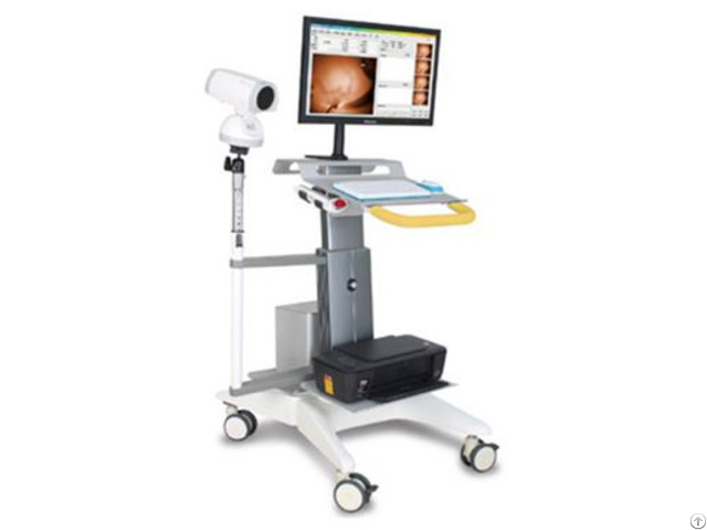 Ykd 1001 Full Hd Infrared Mammary Gland Examination System