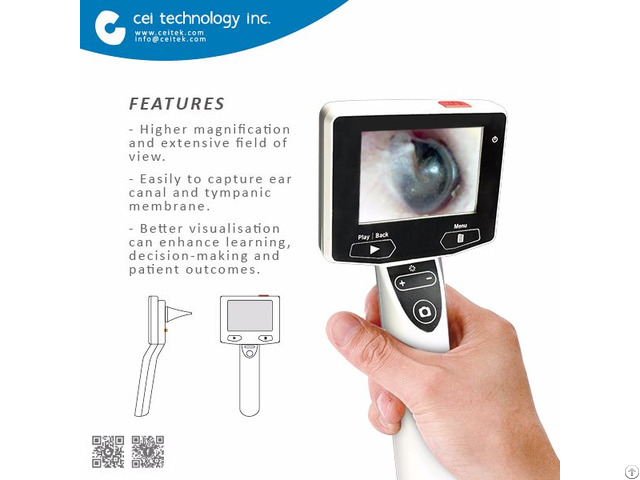 Ent Otolaryngology Digital Video Otoscope