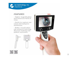 Ent Otolaryngology Digital Video Otoscope