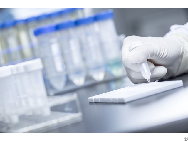 Acetaminophen Ace Rapid Tests