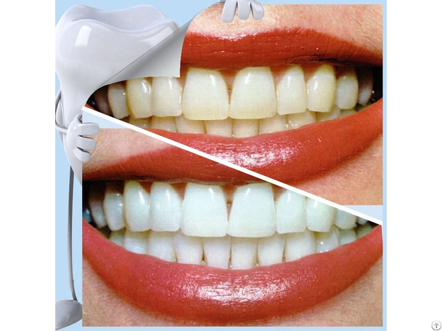 New Brand Tooth Hygiene Goods Teeth Whitening Kits