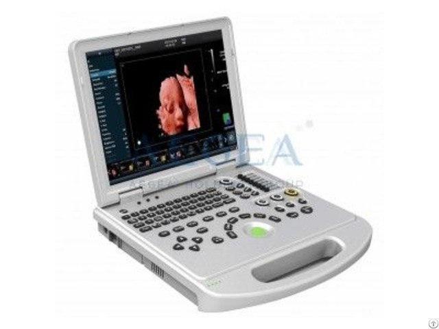 Laptop Color Doppler Portable Ultrasound Scanner