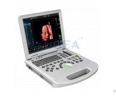 Laptop Color Doppler Portable Ultrasound Scanner