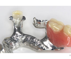 3d Printed Occlusal Splint Orthodontic Clear Aligner