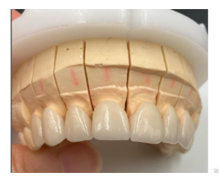 Dental Lab Crown And Bridges