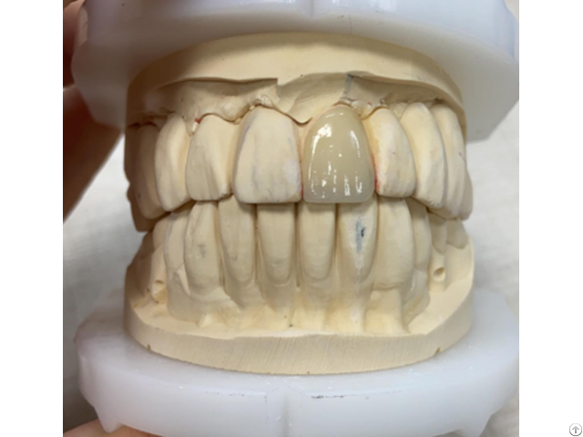 Ceramics Dental Lab North Miami Beach