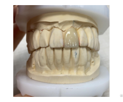 Ceramics Dental Lab North Miami Beach