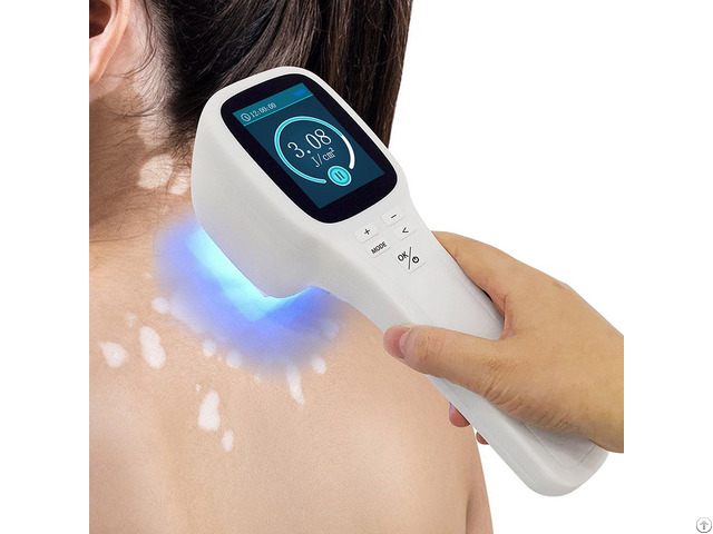 Popular Excimer Laser 308 Nm Uvb Lamp Device For Psoriasis Vitiligo Treatment