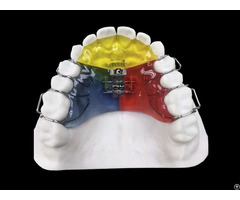 Orthodontic Appliance