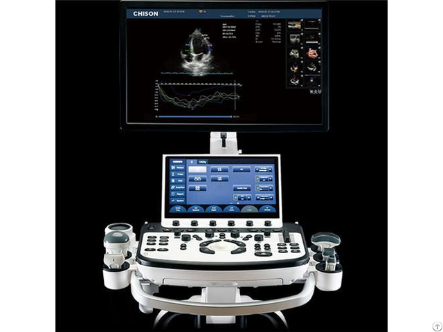Ultrasound Cartbased Machine