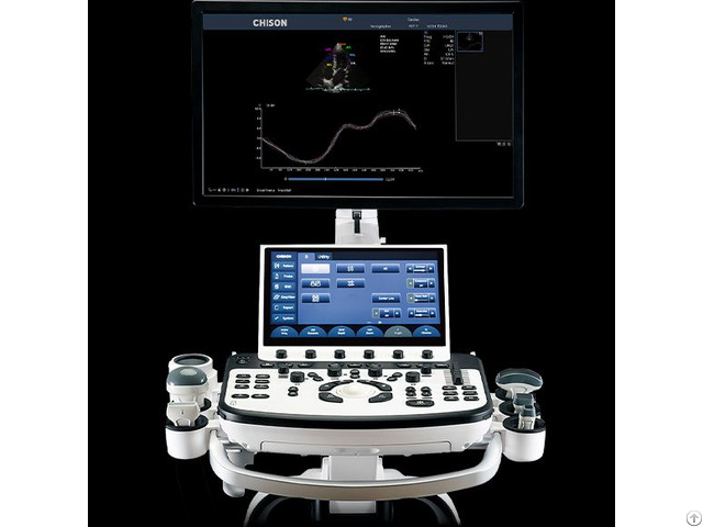 Cardiology Ultrasound System