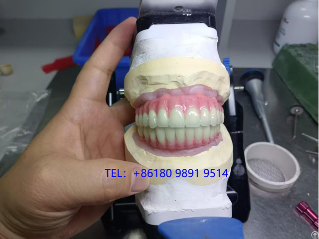 China Screw Retained Implant Bridgegood Quality Comes Initial