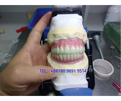 China Screw Retained Implant Bridgegood Quality Comes Initial