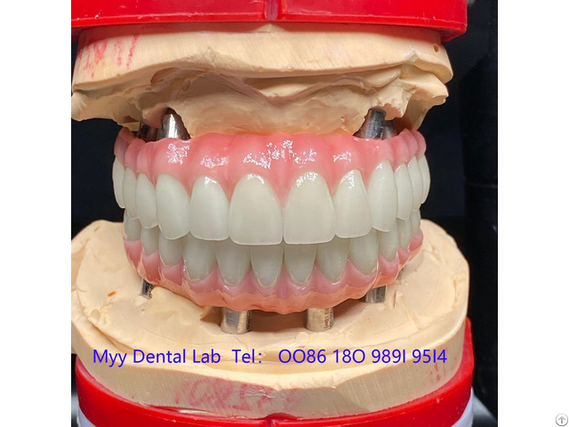 Oem Implant Zirconia Dental Crown Fixed Bridge