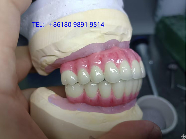 The Myy Implant Dental Lab