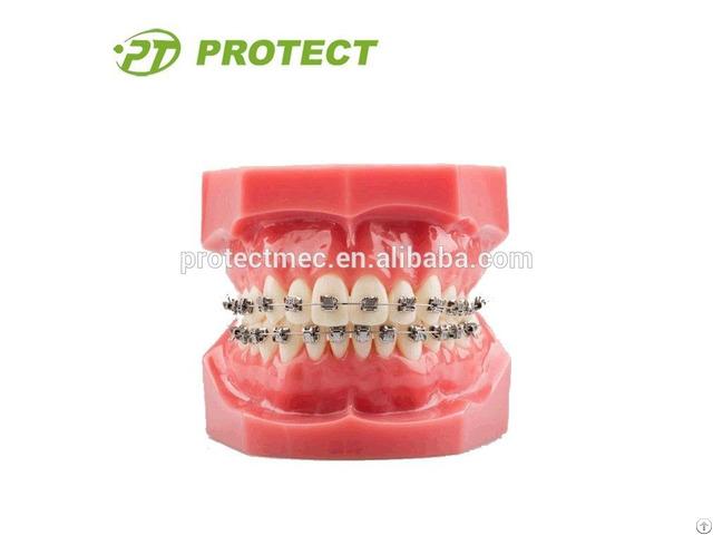Orthodontic Training Typodont With Metal Brackets For Sale
