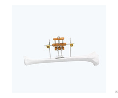 Tibia Transverse Bone Transport System