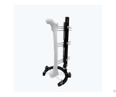Hybrid Fixator Assembly For Reconstruction