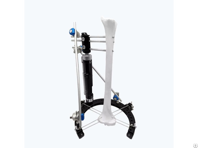 Lower Limb Hybrid Fixator Assembly