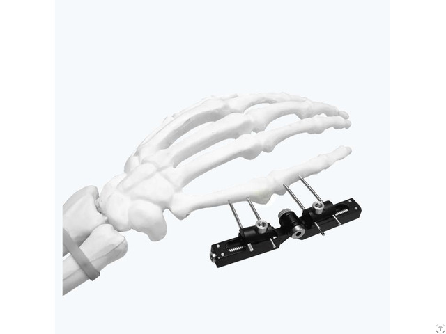 Mini External Fixator Symmetry Axis