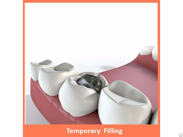 Temporary Filling