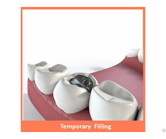 Temporary Filling