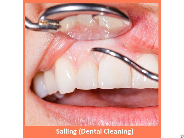 Salling Dental Cleaning