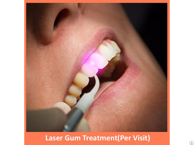 Laser Gum Treatment Per Visit