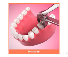 Dental Extraction