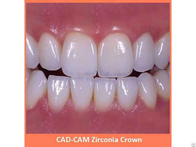 Cad Cam Zirconia Crown