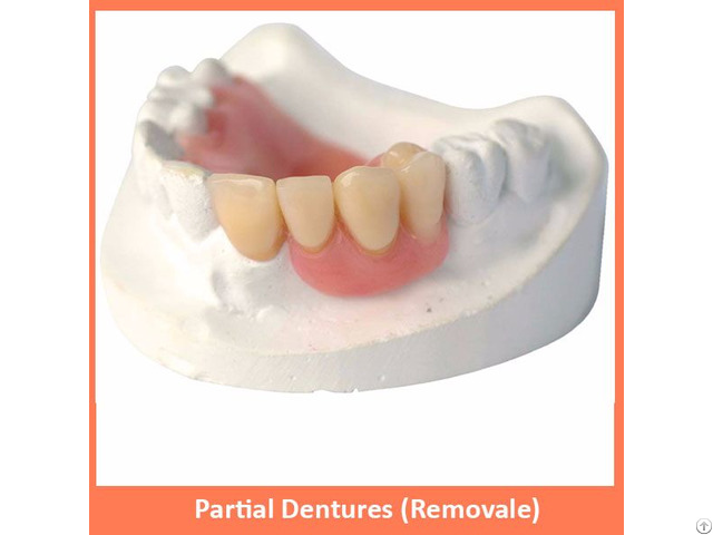 Partial Dentures Removale