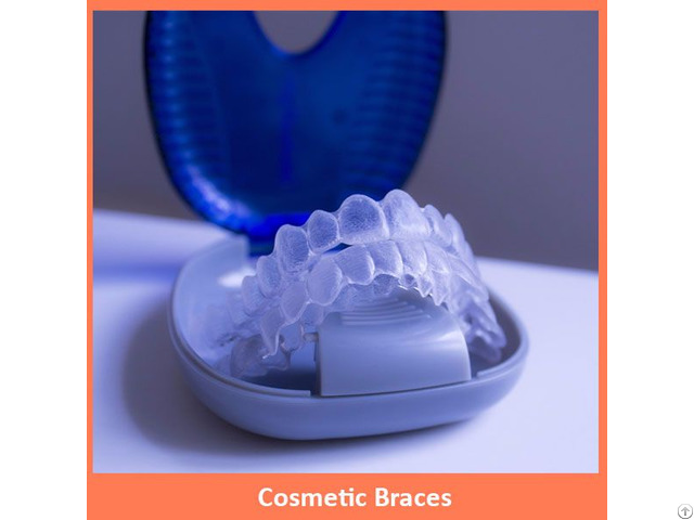 Cosmetic Braces