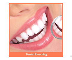 Dental Bleaching