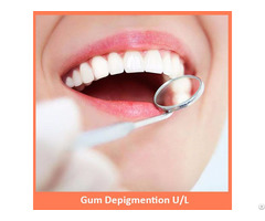 Gum Depigmention Both U L