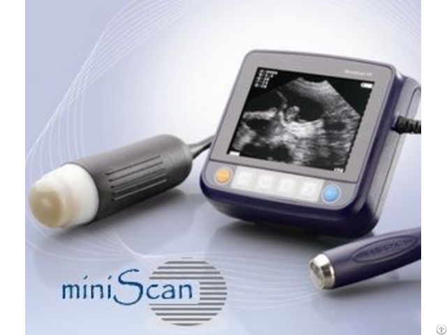 Miniscan Wrist Ultrasound Scanner