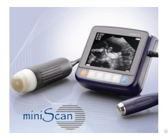 Miniscan Wrist Ultrasound Scanner