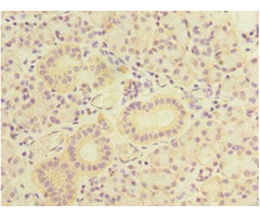 Tbcb Antibody Biotin Conjugated