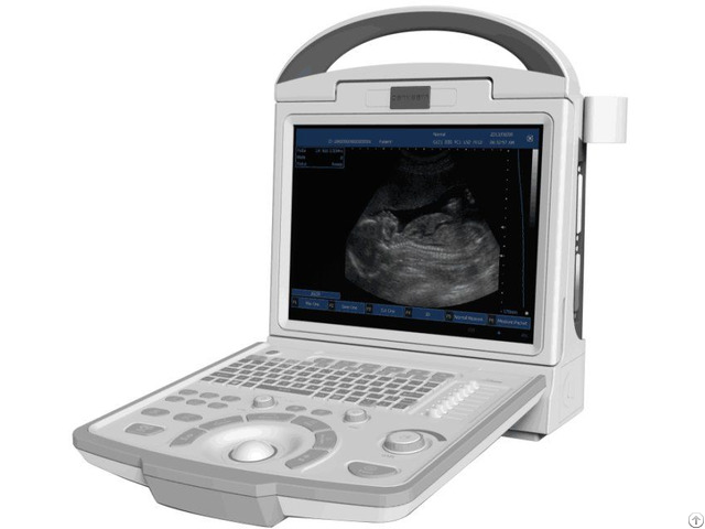 A65 Full Digital Portable Ultrasonic Diagnostic System Black And White Ultrasound Scanner