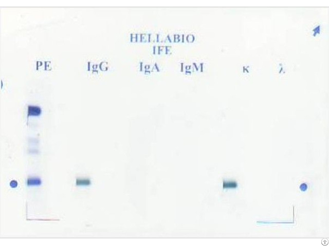 Immunofixation Electrophoresis Kit