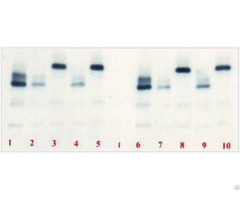 Hemoglobin Electrophoresis Kit In Alkali