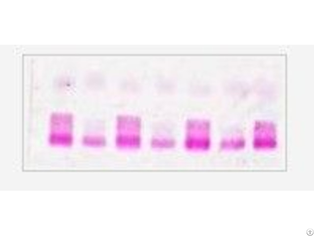 Lipoprotein Electrophoresis Kit